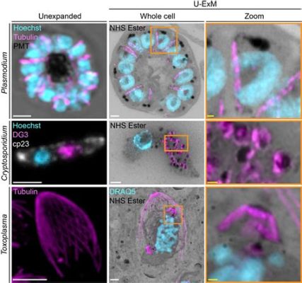  Apicomplexa: Des Parasites Microscopiques Qui Dévorent les Cellules de l'Hôte avec une Précision Chirurgicale !