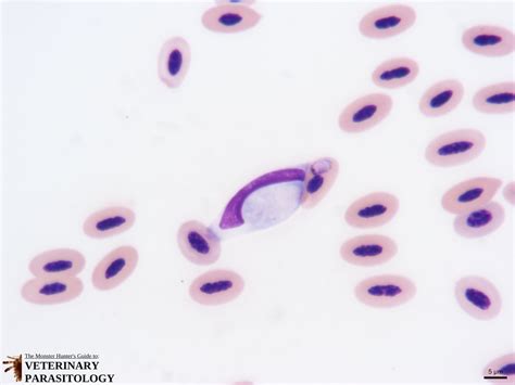 Leucocytozoon! Un Parasite Intrépide Qui Se Délecte Des Globule Blancs de Son Hôte Avian