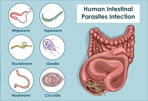  Yersiniose! Une Exploration Profonde de Ce Parasite Intriguant qui Peut Causer des Symptômes Digestifs Perturbants